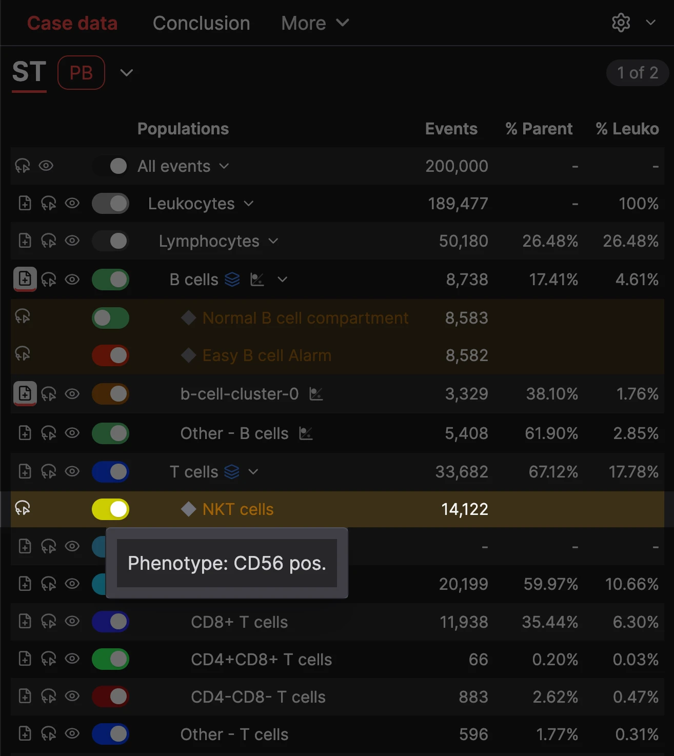 Cell population tree highlighting NKT cells identified by a CD56-positive phenotype